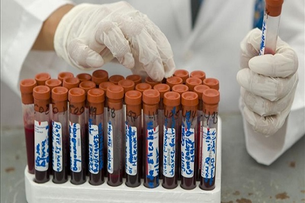 Semana de testeos gratuitos de VIH y sífilis en los centros de salud