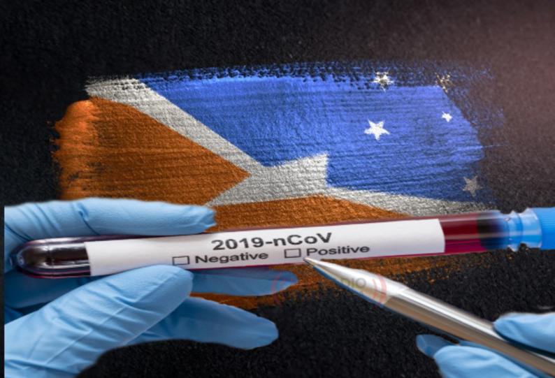 coronavirus