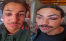 golpiza maldito ibiza