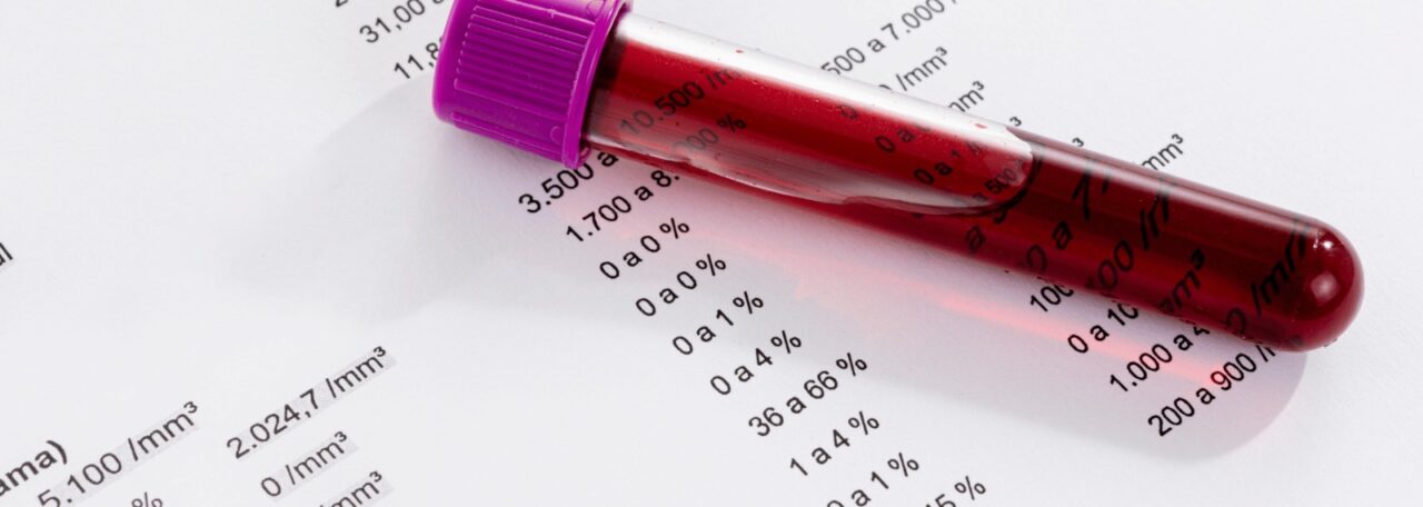 Perfil Lipídico: El análisis que ayuda a detectar el riesgo cardiovascular