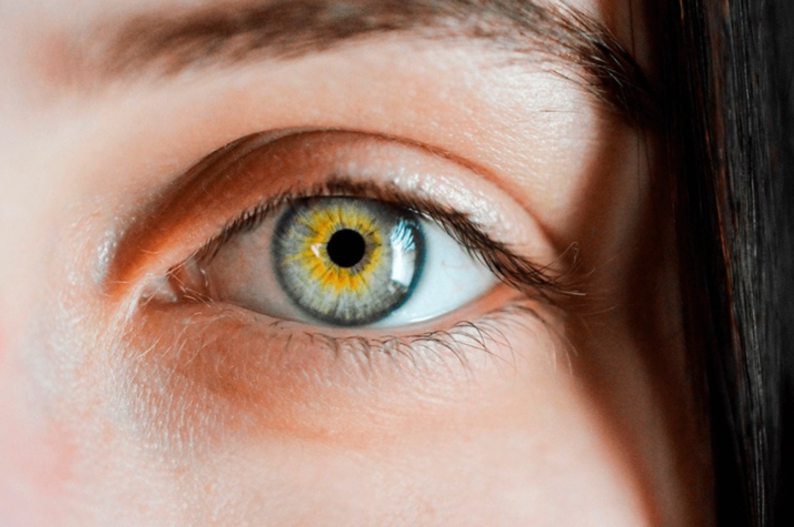 El glaucoma es la primera causa de ceguera y el 50% de las personas no sabe que lo tiene